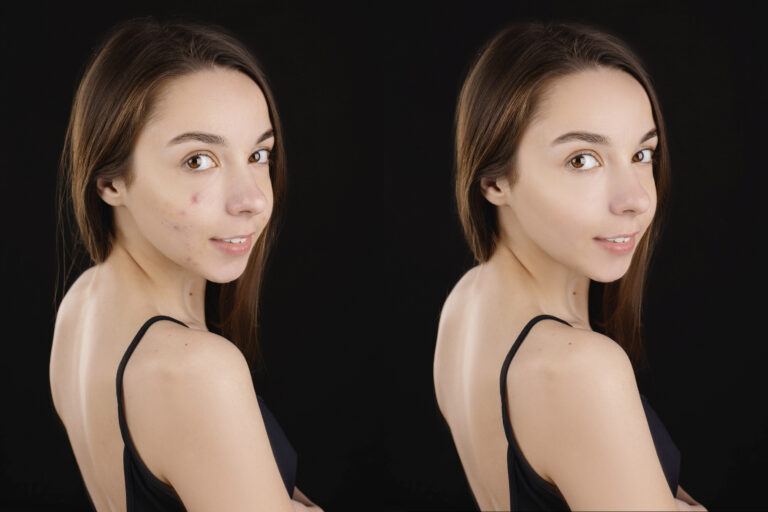 Anna Before After Basic Retouch